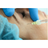 aplicação de botox nas axilas preço Heliópolis