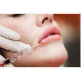 micropigmentação labial marcar Cupecê