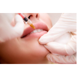 onde fazer micropigmentação labial Vila Gertrudes